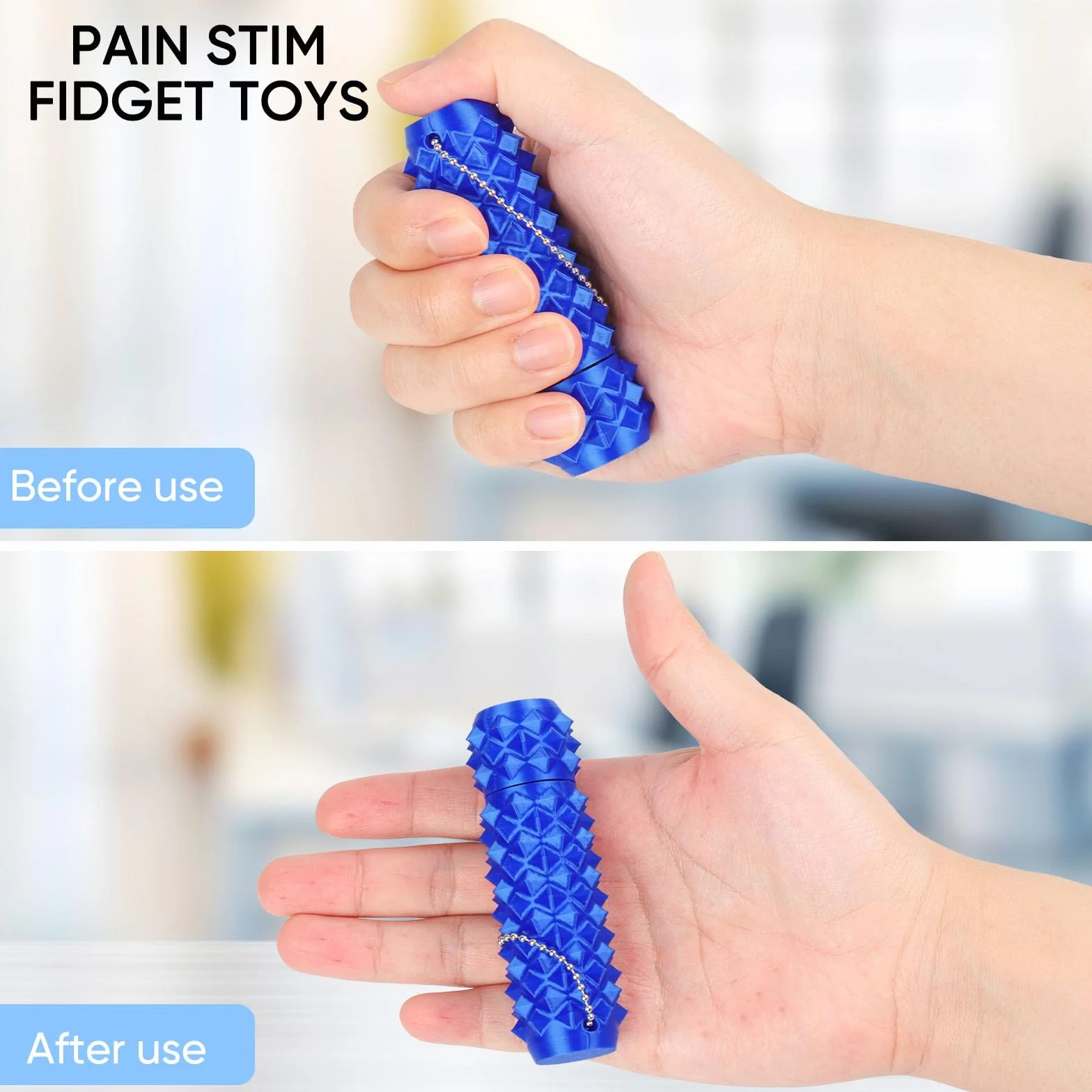 Little Ouchies Spiky Pain Fidget Toys 2-częściowy zestaw zabawek sensorycznych ADHD